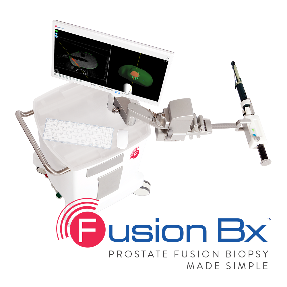 Focal Healthcares Fusion Bx 2 0 Targeted Prostate Biopsy Solution